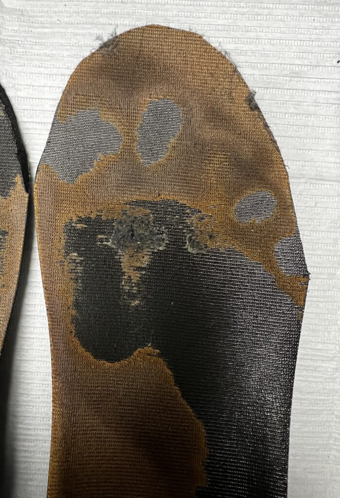 wear marks on insoles due to poor foot function